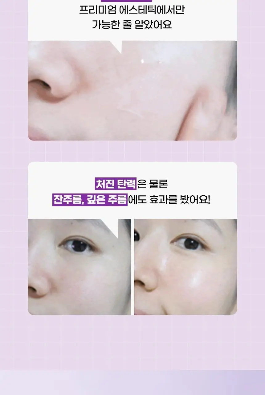 [녹는실앰플] 앰플엔 펩타이드샷 2X 모공탄력앰플 100ml 상세페이지 4